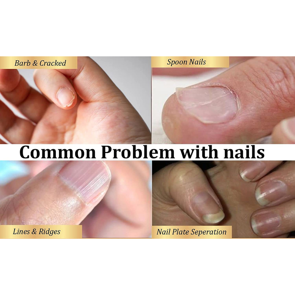 Zen Nail Cuticle Oil (30ml)